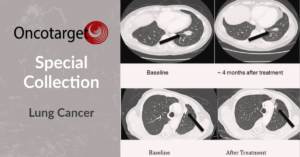 Graphic image for Oncotarget Special collection on Lung Cancer