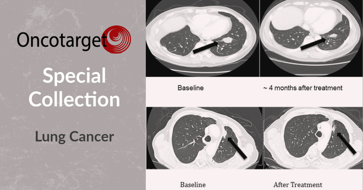 Graphic image for Oncotarget Special collection on Lung Cancer