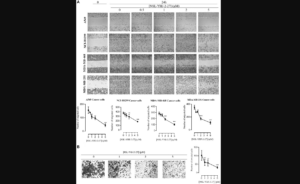 Figure 5: NSL-YHJ-2-27 suppresses cancer cell migration and invasion.