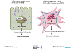 Figure 1: Upon activation by the specific agonist LY500307 ERβ binds to estrogen receptor binding elements (ERE) in regulatory regions of GPR141 and ELMO1 genes and suppresses their transcription, which in turn leads to diminished RhoC activation, reduced actin-based cell migration and metastasis.