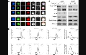 Figure 1: Optimization of circulating tumor cells (CTC) staining and validation of p300 activity.