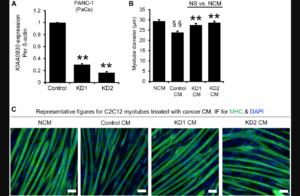 Figure 2: ShRNAs targeting KIAA0930 decrease KIAA0930 mRNA expression and suppress muscle atrophy in PANC-1 cells in vitro.