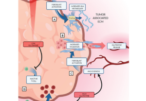 Figure 1: Glutamine metabolism effect in tumor microenvironment cells.