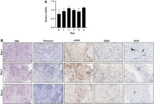 Figure 1: (A) Sliced fresh tumor samples were cultured in 96-well plates and viability was measured with PrestoBlue daily for 5 days. X-axis is days, and Y-axis is proportion of viability. (B) Sliced fresh tumor samples were embedded with paraffin, and tissue sections were stained with hematoxylin and eosin (H&E), Masson trichrome, αSMA, CD34 and Ki-67 antibodies.