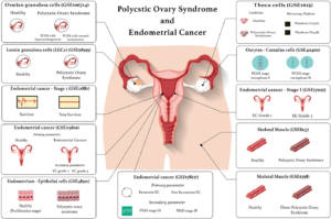 Figure 4: Visual representation of the datasets used in this study on EC and PCOS