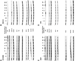 Figure 2: Immunoblot assessment of effects on cell-cycle, pro- and anti-apoptosis signaling events mediated by Sacituzumab govitecan plus platinum-based chemotherapeutics in human TNBC, SCLC, and UBC tumor-lines.