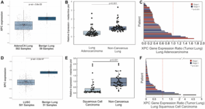 Cigarette Smoke and DNA Repair Deficiency Drive Lung Cancer Development