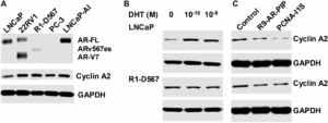 Targeting PCNA-Androgen Receptor Interaction Suppresses Prostate Cancer Cell Growth