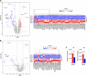 Prostate Cancer Cells Survive Treatment by Storing Fat in Low Oxygen Conditions
