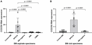 Study Identifies Key Genetic Alterations and Biomarker for Blastic Plasmacytoid Dendritic Cell Neoplasm