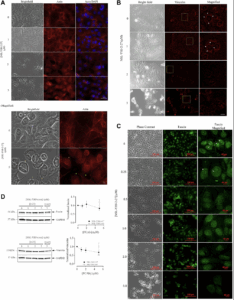 New Compound Disrupts Survival Pathways in Aromatase Inhibitor-Resistant Breast Cancer Cells